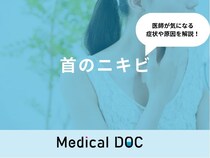 「首にニキビ」ができる原因とは？しこりのようなニキビも解説！