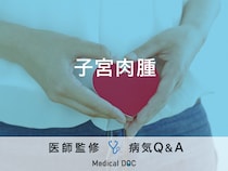 「子宮肉腫」を発症すると現れる初期症状はご存知ですか？医師が監修！