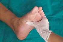 糖尿病になってしまった…足を切断しないためにチェックするポイントを解説