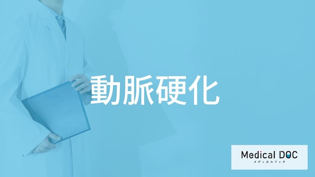 「動脈硬化」はどんな病気？【医師監修】