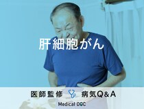 「肝細胞がん」になると現れる症状や原因はご存知ですか？ステージについても解説！