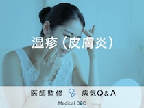 「湿疹（皮膚炎）」の原因・薬の選び方や注意点はご存知ですか？医師が監修！