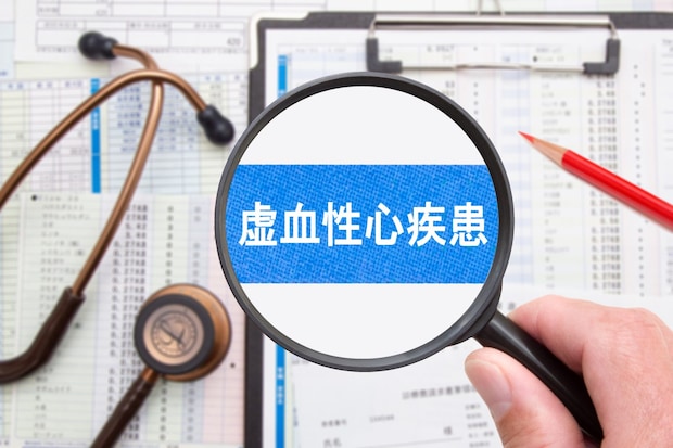 虚血性心疾患とは？ 胸痛の特徴は？