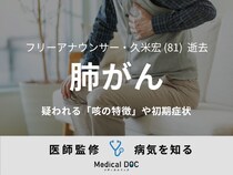 【訃報】久米宏さん 『肺がん』の「咳の特徴」や初期症状を医師が解説