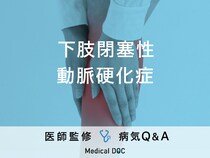 「下肢閉塞性動脈硬化症」の初期症状・原因はご存知ですか？医師が監修！