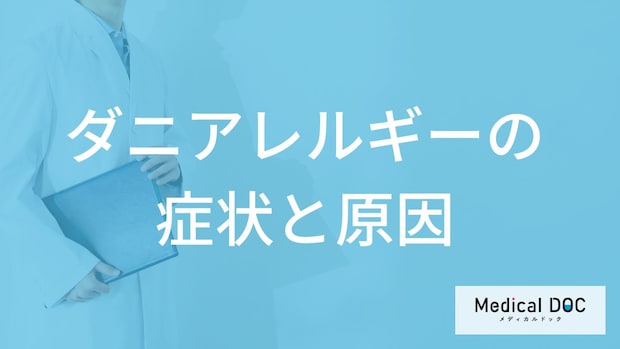 ”食べ物が原因”で「ダニアレルギー」が起きる？注意すべき食材と症状を医師が解説！