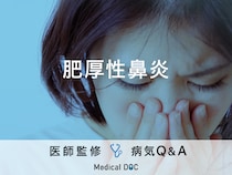 「肥厚性鼻炎」を疑う鼻の症状・原因はご存知ですか？医師が監修！