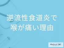 「逆流性食道炎」を発症すると「喉にどんな痛みの特徴」が現れる？【医師監修】