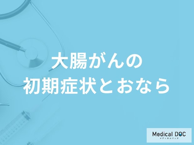 「大腸がんの初期症状」と「おなら」の関係性とは？医師が監修！