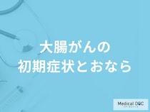「大腸がんの初期症状」と「おなら」の関係性とは？医師が監修！