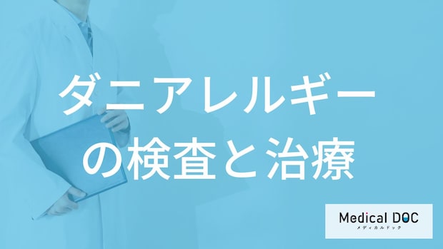 「ダニアレルギー」で”使用される薬”とは？治療の流れや検査法を医師が解説！