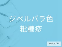 その発疹やかゆみ、「ジベルバラ色粃糠疹」が原因かも？ 初期症状と進行パターンを医師が解説