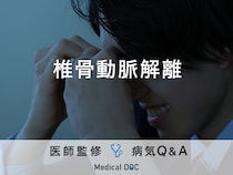 「椎骨動脈解離」を発症すると現れる症状・原因はご存知ですか？医師が監修！