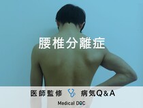 「腰椎分離症」は放置すると危険？医師が徹底解説！