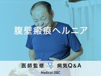 「腹壁瘢痕ヘルニア」の症状・原因・発症しやすい人の特徴はご存知ですか？