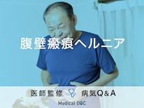 「腹壁瘢痕ヘルニア」の症状・原因・発症しやすい人の特徴はご存知ですか？