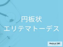 「円板状エリテマトーデス」の初期症状を医師が解説 見逃しやすい皮膚の変化とは