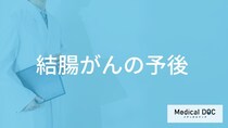 「結腸がんの生存率」はご存じですか？余命を医師が解説！