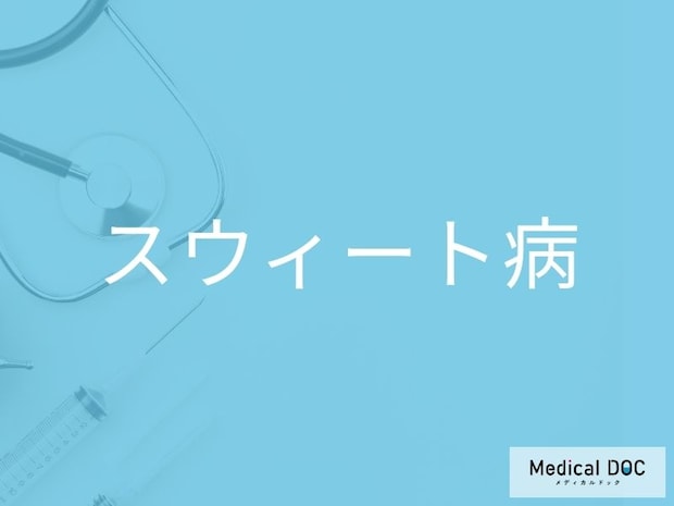 「スウィート病」の症状と前兆を医師が解説 発熱・紅斑が出たときの注意点