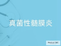 「真菌性髄膜炎」の初期症状を医師が解説 どのような頭痛に注意すればいい？