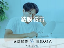 「結膜結石」を発症すると現れる症状・原因はご存知ですか？医師が監修！