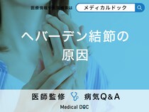 「へバーデン結節の原因」はご存知ですか？症状や何科を受診するべきかも解説！