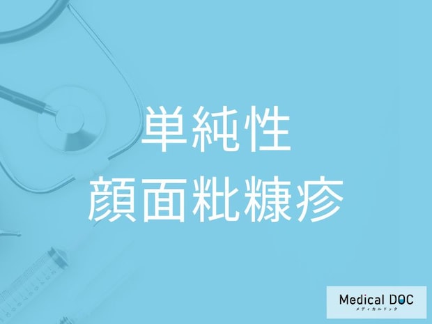 顔に白い斑が出る「単純性顔面粃糠疹」幼児に多い理由や特徴を医師が解説