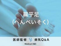 「扁平足」の症状・原因・セルフチェック法はご存知ですか？医師が監修！