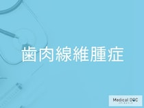 「歯肉線維腫症」の初期症状を医師が解説 歯の萌出や咀嚼への影響とは