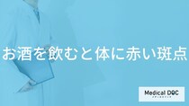 「お酒を飲むと体に赤い斑点」ができる原因はご存知ですか？