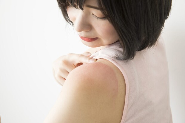 日焼けとは何か？ 紫外線が体に与える影響と"黒くなる仕組み"