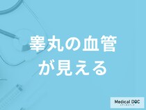 「睾丸の血管が見える」のは”病気”のサイン？受診の目安となる症状も医師が解説！