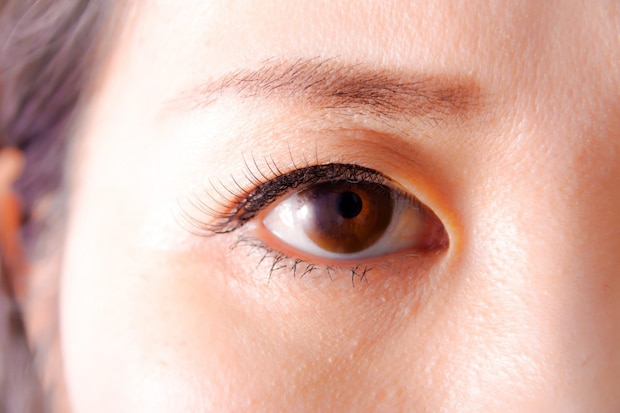 閉塞隅角(ぐうかく)緑内障の基礎知識