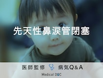 「先天性鼻涙管閉塞」を発症すると現れる症状・原因はご存知ですか？医師が監修！