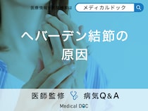 「へバーデン結節の原因」はご存知ですか？症状や何科を受診するべきかも解説！