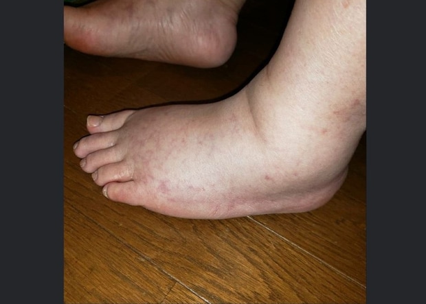 病気発症後の生活状況