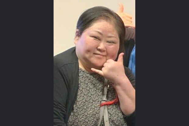 【闘病】「顔が別人のように…」 難病『皮膚筋炎』で救急搬送された理由と副作用