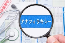 「アナフィラキシーショック」とは？症状・原因について詳しく解説！