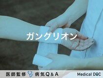 「ガングリオン」とは？原因・治療法・放置するとどうなるかについても解説！