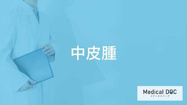 「中皮腫」の初期症状はご存知ですか？原因や検査・治療法も医師が徹底解説！