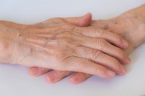手指が曲がってしまうヘバーデン結節とは？ 自宅でできるリハビリについて作業療法士に聞く