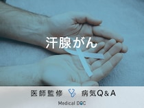 「汗腺がん」を発症すると現れる症状・原因・予防法はご存知ですか？医師が監修！