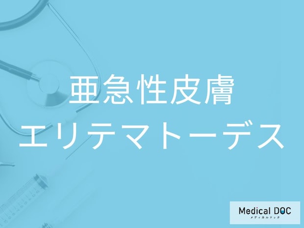 その皮疹、日光が原因かも? 「亜急性皮膚エリテマトーデス」の初期症状と早期発見のポイントを医師に聞く