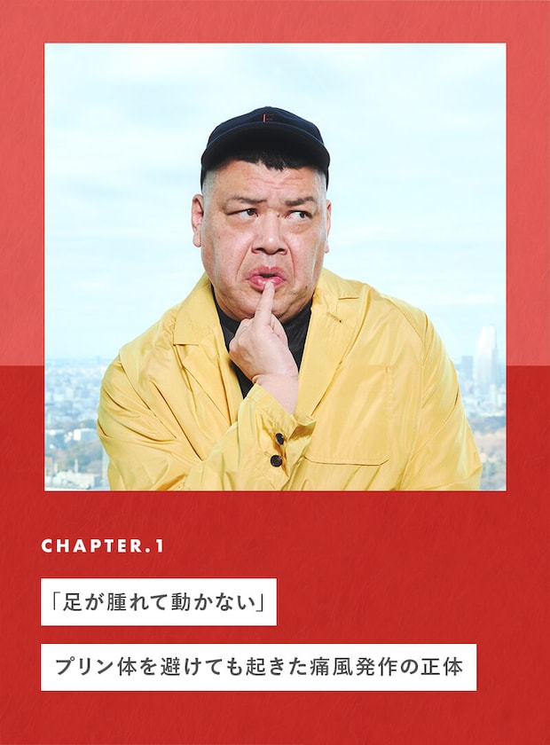 「足が腫れて動かない」プリン体を避けても起きた痛風発作の正体
