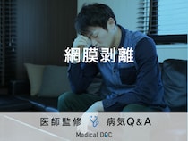 「網膜剥離」の症状・原因・手術はご存知ですか？医師が監修！