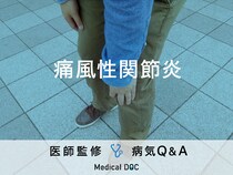 「痛風性関節炎」を発症すると現れる症状・原因はご存知ですか？医師が監修！