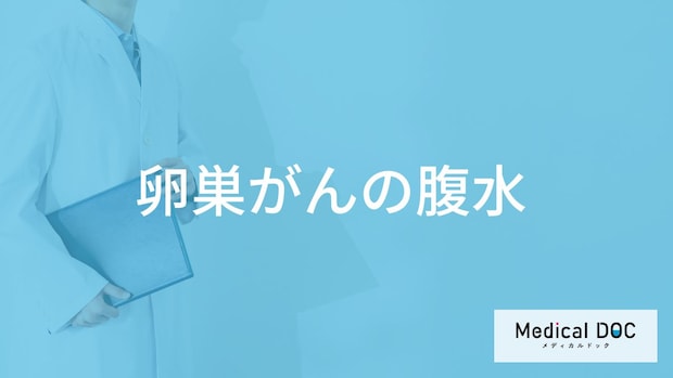 「卵巣がん」が進行すると「腹水」になる？症状について解説！【医師監修】