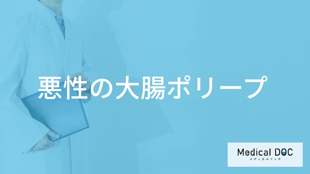 「大腸ポリープが悪性の場合」どのように対処する?ポリープができる原因や症状も解説!