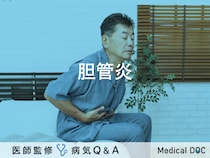 「胆管炎」とは？症状・原因・治療法も解説！【医師監修】