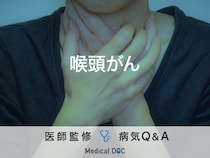 「喉頭がん」の自覚症状・原因はご存知ですか？医師が監修！